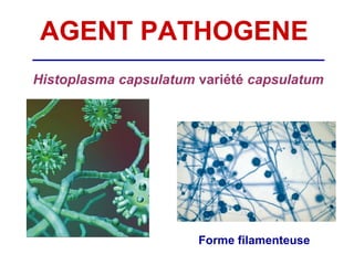 AGENT PATHOGENE
Histoplasma capsulatum variété capsulatum




                       Forme filamenteuse
 