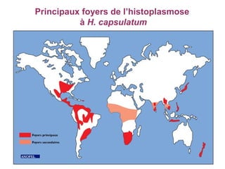 Principaux foyers de l’histoplasmose
          à H. capsulatum
 