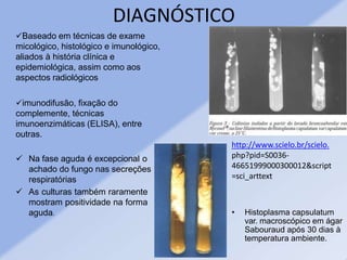 DIAGNÓSTICO
Baseado em técnicas de exame
micológico, histológico e imunológico,
aliados à história clínica e
epidemiológica, assim como aos
aspectos radiológicos
imunodifusão, fixação do
complemente, técnicas
imunoenzimáticas (ELISA), entre
outras.
 Na fase aguda é excepcional o
achado do fungo nas secreções
respiratórias
 As culturas também raramente
mostram positividade na forma
aguda. • Histoplasma capsulatum
var. macroscópico em ágar
Sabouraud após 30 dias à
temperatura ambiente.
http://www.scielo.br/scielo.
php?pid=S0036-
46651999000300012&script
=sci_arttext
 
