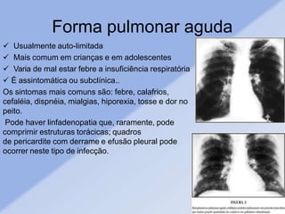 Forma pulmonar aguda
 Usualmente auto-limitada
 Mais comum em crianças e em adolescentes
 Varia de mal estar febre a insuficiência respiratória
 É assintomática ou subclínica..
Os sintomas mais comuns são: febre, calafrios,
cefaléia, dispnéia, mialgias, hiporexia, tosse e dor no
peito.
Pode haver linfadenopatia que, raramente, pode
comprimir estruturas torácicas; quadros
de pericardite com derrame e efusão pleural pode
ocorrer neste tipo de infecção.
 