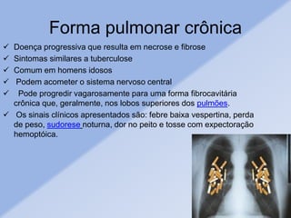 Forma pulmonar crônica
 Doença progressiva que resulta em necrose e fibrose
 Sintomas similares a tuberculose
 Comum em homens idosos
 Podem acometer o sistema nervoso central
 Pode progredir vagarosamente para uma forma fibrocavitária
crônica que, geralmente, nos lobos superiores dos pulmões.
 Os sinais clínicos apresentados são: febre baixa vespertina, perda
de peso, sudorese noturna, dor no peito e tosse com expectoração
hemoptóica.
 