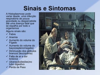 Sinais e Sintomas
A Histoplasmose pode
variar desde uma infecção
respiratória de pouca
gravidade ou despercebida
até uma doença fatal que
se espalha por todo o
organismos
Alguns sinais são:
 Febre
 Anemia
 Aumento do volume do
Fígado
 Aumento do volume do
baço(esplenomegalia)
 Diminuição dos glóbulos
brancos (leucopenia)
 Falta de ar e dor
torácica
 Ulceração(lesões)no
tubo digestivo
 Perda de Peso
 