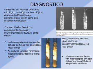 DIAGNÓSTICO
Baseado em técnicas de exame
micológico, histológico e imunológico,
aliados à história clínica e
epidemiológica, assim como aos
aspectos radiológicos
 imunodifusão, fixação do
complemente, técnicas
imunoenzimáticas (ELISA), entre
outras.
 Na fase aguda é excepcional o
achado do fungo nas secreções
respiratórias
 As culturas também raramente
mostram positividade na forma
aguda. • Histoplasma capsulatum
var. macroscópico em ágar
Sabouraud após 30 dias à
temperatura ambiente.
http://www.scielo.br/scielo.
php?pid=S0036-
46651999000300012&script
=sci_arttext
 
