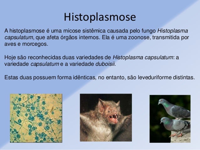 Histoplasmose Histoplasmose