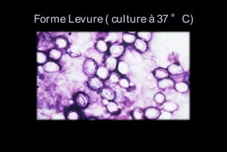 Forme Levure ( culture à 37 °C)

 