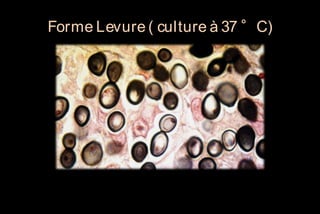 Forme Levure ( culture à 37 °C)

 