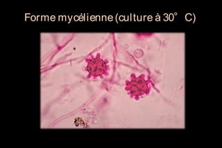 Forme mycélienne (culture à 30°C)

 
