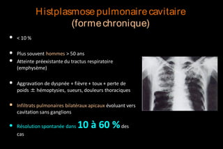 Histplasmose pulmonaire cavitaire
(forme chronique)
•

< 10 %

•
•

Plus souvent hommes > 50 ans
Atteinte préexistante du tractus respiratoire
(emphysème)

•

Aggravation de dyspnée + fièvre + toux + perte de
poids ± hémoptysies, sueurs, douleurs thoraciques

•

Infiltrats pulmonaires bilatéraux apicaux évoluant vers
cavitation sans ganglions

•

Résolution spontanée dans
cas

10 à 60 % des

 