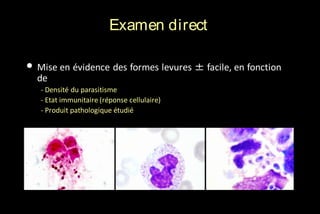 Examen direct
• Mise en évidence des formes levures ± facile, en fonction
de

- Densité du parasitisme
- Etat immunitaire (réponse cellulaire)
- Produit pathologique étudié

 