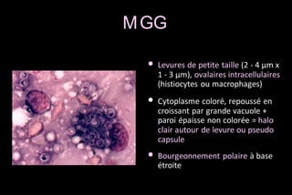 M GG
• Levures de petite taille (2 - 4 μm x

1 - 3 μm), ovalaires intracellulaires
(histiocytes ou macrophages)

• Cytoplasme coloré, repoussé en

croissant par grande vacuole +
paroi épaisse non colorée = halo
clair autour de levure ou pseudo
capsule

• Bourgeonnement polaire à base
étroite

 