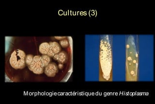 Cultures (3)

M orphologie caractéristique du genre Histoplasma

 