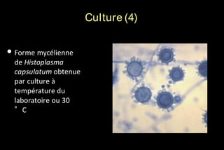 Culture (4)

• Forme mycélienne
de Histoplasma
capsulatum obtenue
par culture à
température du
laboratoire ou 30
°C

 