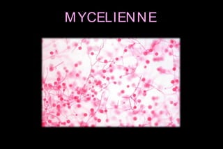 M YCELIEN N E

 