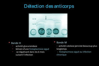 Détection des anticorps

• Bande H
-

activité glucuronidase
témoin d'une histoplasmose aiguë
se négativant dans les 6 mois
suivant l'infection

• Bande M
- activité catalase persiste beaucoup plus
longtemps
- histoplasmose aiguë ou infection
chronique

 