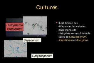 Cultures
• Il est difficile des

Histoplasma
capsulatum

Sepedonium

Chrysosporium

différencier les colonies
mycéliennes de
Histoplasma capsulatum de
celles de Chrysosporium,
Sepedonium et Renispora

 