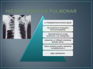 a- Histoplasmosis primaria aguda

Se presenta en hospedero
inmunocompetente.
Generalmente en zonas
endémicas. Las radiografías
presentan un infiltrado intersticial
alveolar difuso.
Estos cambios pueden resolverse
completamente o
dejar calcificación.

 