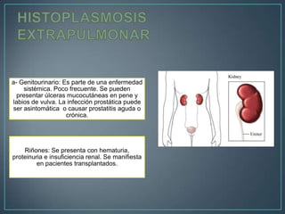 a- Genitourinario: Es parte de una enfermedad
sistémica. Poco frecuente. Se pueden
presentar úlceras mucocutáneas en pene y
labios de vulva. La infección prostática puede
ser asintomática o causar prostatitis aguda o
crónica.

Riñones: Se presenta con hematuria,
proteinuria e insuficiencia renal. Se manifiesta
en pacientes transplantados.

 