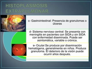 c- Gastrointestinal: Presencia de granulomas o
úlceras
d- Sistema nervioso central: Se presenta con
meningitis en pacientes con SIDA y sin SIDA
con enfermedad diseminada. Puede ser
asintomática, variable o crónica.
e- Ocular:Se produce por diseminación
hematógena, generalmente en niños. Produce
granuloma. El deterioro de la visión puede
ocurrir años después.

 