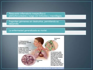 Respuesta inflamatoria inespecífica a
pilimorfonucleares y luego con linfocitos y macrófagos.
Fagocitan gérmenes sin destruirlos, permitiendo su
desarrollo
La enfermedad generalizada es mortal.

 