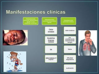 Histoplasmosis
pulmonar asintomática
aguda: no se
presentan síntomas

Histoplasmosis
pulmonar sintomática
aguda:

Histoplasmosis
pulmonar crónica:

Fiebre
artralgias

dolor torácico

Escalofríos
Eritemas
nodosos

tos,
posiblemente
expectorando
sangre

tos

fiebre

dolor torácico al
inspirar

dificultad
respiratoria

sudoración

 