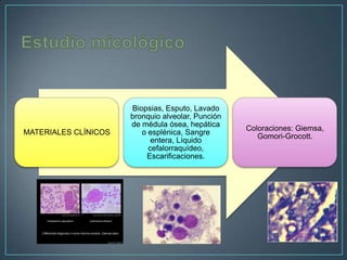 MATERIALES CLÍNICOS

Biopsias, Esputo, Lavado
bronquio alveolar, Punción
de médula ósea, hepática
o esplénica, Sangre
entera, Líquido
cefalorraquídeo,
Escarificaciones.

Coloraciones: Giemsa,
Gomori-Grocott.

 