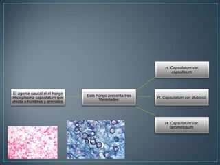 H. Capsulatum var.
capsulatum.

El agente causal el el hongo
Histoplasma capsulatum que
afecta a hombres y animales.

Este hongo presenta tres
Variedades:

H. Capsulatum var. duboisii.

H. Capsulatum var.
farciminosum.

 