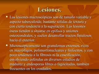 Lesiones.Lesiones.
 Las lesiones macroscópicas son de tamaño variable yLas lesiones macroscópicas son de tamaño variable y
aspecto tuberculoide, bastante sólidas de textura yaspecto tuberculoide, bastante sólidas de textura y
con cierta tendencia a la supuración. Las lesionescon cierta tendencia a la supuración. Las lesiones
óseas tienden a situarse en epífisis y unionesóseas tienden a situarse en epífisis y uniones
osteocondrales, y suelen desarrollar tractos fistulosososteocondrales, y suelen desarrollar tractos fistulosos
hacia el exterior.hacia el exterior.
 Microscópicamente son granulomas extensos, ricosMicroscópicamente son granulomas extensos, ricos
en macrófagos, polimorfonucleares y linfocitos, y conen macrófagos, polimorfonucleares y linfocitos, y con
poca tendencia a la fibrosis ni la caseificación,poca tendencia a la fibrosis ni la caseificación,
envolviendo esférulas en diversos estadios deenvolviendo esférulas en diversos estadios de
madurez y endosporas libres o fagocitadas, tambiénmadurez y endosporas libres o fagocitadas, también
frecuentes en los exudados.frecuentes en los exudados.
 