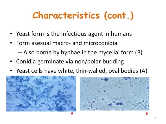 histoplasmosis mycelial form