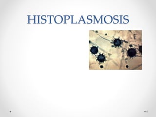 HISTOPLASMOSIS
4
 