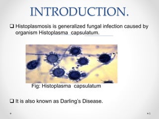 INTRODUCTION.
 Histoplasmosis is generalized fungal infection caused by
organism Histoplasma capsulatum.
Fig: Histoplasma capsulatum
 It is also known as Darling’s Disease.
5
 