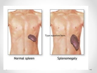 Type equation here.
8
 