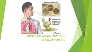 BROTE EPIDEMIOLOGICO DE
HISTOPLASMOSIS
 