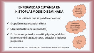 ENFERMEDAD CUTÁNEA EN
HISTOPLASMOSIS DISEMINADA
Las lesiones que se pueden encontrar:
 Erupción maculopapular difusa
 Ulceración (lesiones avanzadas)
 En inmunosuprimidos no-VIH: pápulas, nódulos,
lesiones umbilicadas, úlceras, pústulas y lesiones
purpúricas
Infect Dis Clin North Am . 2021 Jun;35(2):471-491 / Clin Dermatol . Nov-Dec 2012;30(6):592-8.
10-25% de
pacientes
con VIH
En América
Latina 38-85%
de pacientes
con VIH
<10% en
USA
 