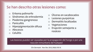 Se han descrito otras lesiones como:
o Úlceras en sacabocados
o Lesiones purpúricas
o Dermatitis localizadas
o Vegetaciones
o Erupción semejante a
rosácea
o Eritema polimorfo
o Síndromes de eritrodermia
o Pioderma gangrenoso
o Paniculitis
o Hiperpigmentación difusa
o Abscesos
o Celulitis
Clin Dermatol . Nov-Dec 2012;30(6):592-8.
Las lesiones pueden ser causadas por la propagación del hongo o por una
reacción inmunitaria del huésped
 