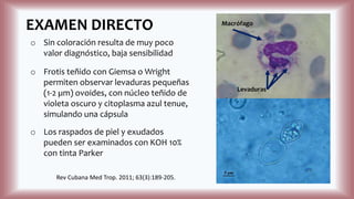 EXAMEN DIRECTO
o Sin coloración resulta de muy poco
valor diagnóstico, baja sensibilidad
o Frotis teñido con Giemsa o Wright
permiten observar levaduras pequeñas
(1-2 µm) ovoides, con núcleo teñido de
violeta oscuro y citoplasma azul tenue,
simulando una cápsula
o Los raspados de piel y exudados
pueden ser examinados con KOH 10%
con tinta Parker
Rev Cubana Med Trop. 2011; 63(3):189-205.
Macrófago
Levaduras
 