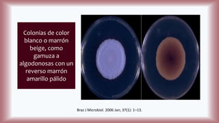 Colonias de color
blanco o marrón
beige, como
gamuza a
algodonosas con un
reverso marrón
amarillo pálido
Braz J Microbiol. 2006 Jan; 37(1): 1–13.
 