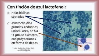 Con tinción de azul lactofenol:
o Hifas hialinas
septadas
o Macroconidios
grandes, redondos,
unicelulares, de 8 a
14 μm de diámetro,
con proyecciones
en forma de dedos
Infect Dis Clin North Am . 2021
Jun;35(2):471-491.
 