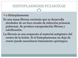 HISTOPLASMOSIS PULMONAR
c-Histoplasmoma
Es una masa fibrosa creciente que se desarrolla
alrededor de un foco curado de infección primaria
pulmonar. Se produce encapsulación fibrosa y
calcificación.
La fibrosis es una respuesta al material antigénico del
centro de la lesión. Si el histoplasmoma no deja de
crecer puede necesitarse tratamiento quirúrgico.
 