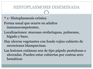 HISTOPLASMOSIS DISEMINADA
c- Histoplasmosis crónica
Forma usual que ocurre en adultos
inmunocompetentes.
Localizaciones: mucosas orofaríngeas, pulmones,
hígado y bazo.
Hay ulceras vegetantes con fondo rojizo cubierto de
secreciones blanquecinas.
Las lesiones cutáneas son de tipo pápulo pustulosas o
ulceradas. Pueden estar cubiertas por costras sero
hemáticas
 