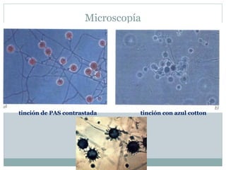 Microscopía
tinción de PAS contrastada tinción con azul cotton
 