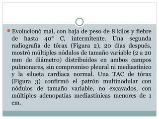 Evolucionó mal, con baja de peso de 8 kilos y fiebre
de hasta 40° C, intermitente. Una segunda
radiografía de tórax (Figura 2), 20 días después,
mostró múltiples nódulos de tamaño variable (2 a 20
mm de diámetro) distribuidos en ambos campos
pulmonares, sin compromiso pleural ni mediastínico
y la silueta cardíaca normal. Una TAC de tórax
(Figura 3) confirmó el patrón multinodular con
nódulos de tamaño variable, no excavados, con
múltiples adenopatías mediastínicas menores de 1
cm.
 
