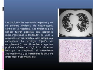 Las baciloscopias resultaron negativas y no
se encontró evidencia de Pneumocystis
carinii en la histología. Las tinciones para
hongos fueron positivas para pequeños
microorganismos redondeados de unos 4
micrones, con los caracteres de Histoplasma
capsulatum. La serología (fijación de
complemento) para Histoplasma spp fue
positiva a títulos de 1/256. A raíz de estos
hallazgos se suspendió el tratamiento
antituberculoso y se incrementó la dosis de
itraconazol a 600 mg/día oral
 
