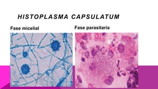 HISTOPLASMA CAPSULATUM
Fase micelial Fase parasitaria
 