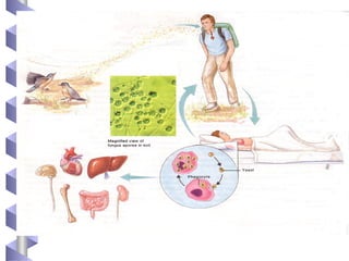 MANIFESTACIONES CLÍNICAS
 