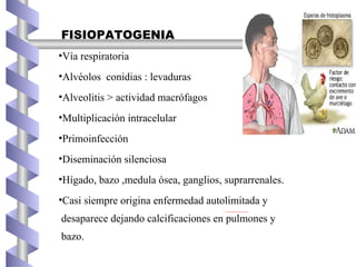 FISIOPATOGENIA
•Vía respiratoria
•Alvéolos conidias : levaduras
•Alveolitis > actividad macrófagos
•Multiplicación intracelular
•Primoinfección
•Diseminación silenciosa
•Hígado, bazo ,medula ósea, ganglios, suprarrenales.
•Casi siempre origina enfermedad autolimitada y
desaparece dejando calcificaciones en pulmones y
bazo.
 