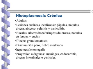 Histoplasmosis Crónica
•Adultos
•Lesiones cutáneas localizadas: pápulas, nódulos,
ulcera, absceso, celulitis y paniculitis.
•Bucales: ulceras bocofaringeas dolorosas, nódulos
en lengua y encías
•Úlceras granulomatosas
•Disminución peso, fiebre moderada
•hepatoesplenomegalia
•Progresión a órganos: meninges, endocarditis,
ulceras intestinales o genitales.
 