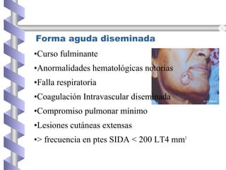 Forma aguda diseminada
•Curso fulminante
•Anormalidades hematológicas notorias
•Falla respiratoria
•Coagulación Intravascular diseminada
•Compromiso pulmonar mínimo
•Lesiones cutáneas extensas
•> frecuencia en ptes SIDA < 200 LT4 mm3
 