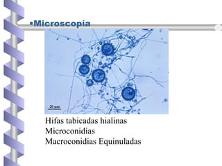 •Microscopía
Hifas tabicadas hialinas
Microconidias
Macroconidias Equinuladas
 