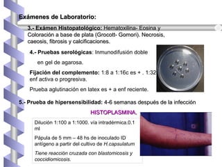 Dilución 1:100 a 1:1000. vía intradérmica.0.1
ml
Pápula de 5 mm – 48 hs de inoculado ID
antígeno a partir del cultivo de H.capsulatum
Tiene reacción cruzada con blastomicosis y
coccidiomicosis.
3.- Exámen Histopatológico: Hematoxilina- Eosina yHematoxilina- Eosina y
Coloración a base de plata (Grocott- Gomori). Necrosis,Coloración a base de plata (Grocott- Gomori). Necrosis,
caeosis, fibrosis y calcificaciones.caeosis, fibrosis y calcificaciones.
5.- Prueba de hipersensibilidad: 4-6 semanas después de la infección4-6 semanas después de la infección
HISTOPLASMINA.HISTOPLASMINA.
4.- Pruebas serológicas: Inmunodifusión doble
en gel de agarosa.
Fijación del complemento: 1:8 a 1:16c es + . 1:32
enf activa o progresiva.
Prueba aglutinación en latex es + a enf reciente.
Exámenes de Laboratorio:Exámenes de Laboratorio:
 