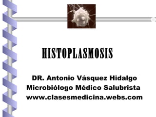 HISTOPLASMOSIS
DR. Antonio Vásquez Hidalgo
Microbiólogo Médico Salubrista
www.clasesmedicina.webs.com
 